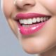 Modern Smile Makeovers Finding the Right Option for Your Budget and Goals